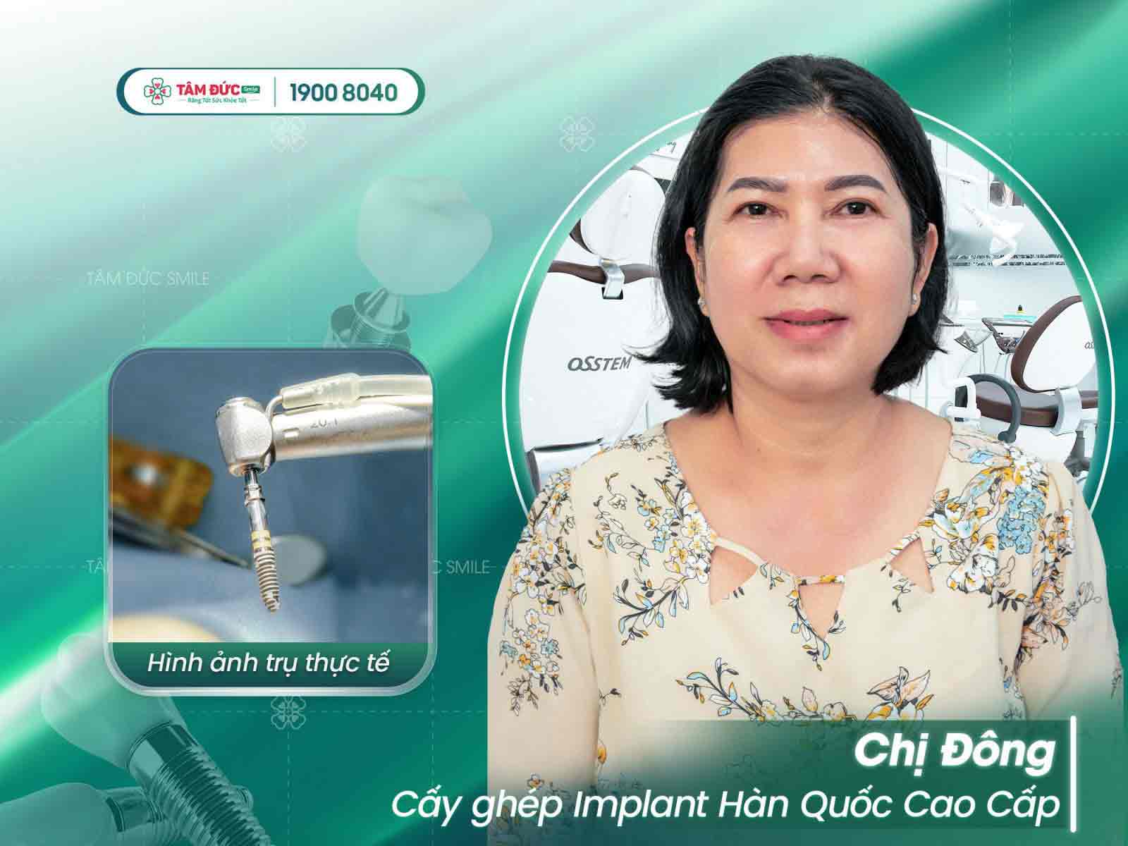 chị Đông cấy ghép implant tại nha khoa Tâm Đức Smile