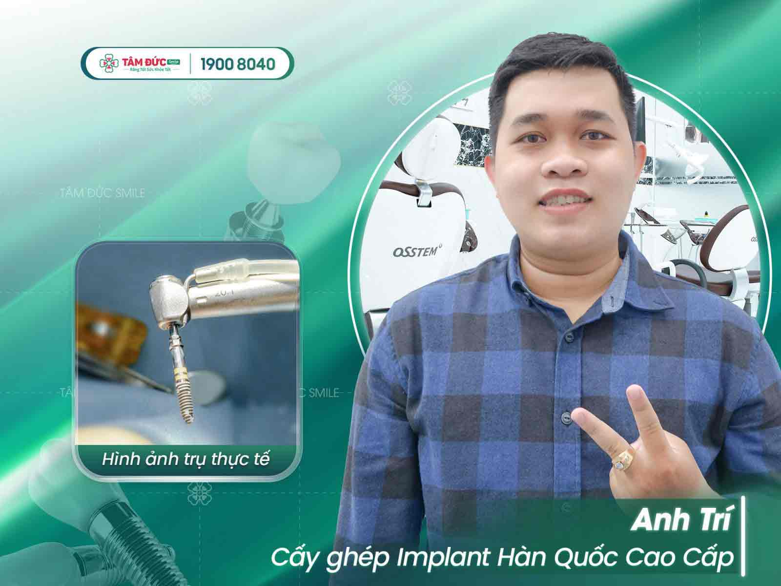 anh trí cấy ghép implant tại nha khoa tâm đức smile