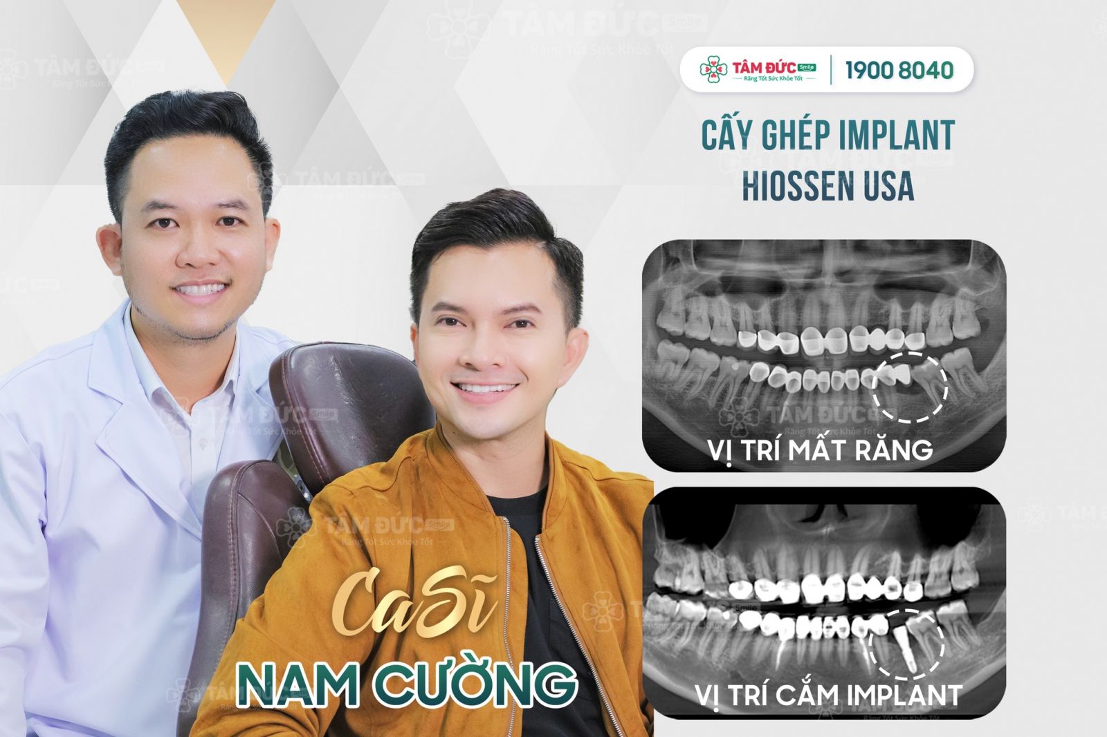 địa chỉ trồng răng implant uy tín tại biên hoà