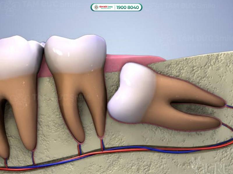 địa chỉ nha khoa nhổ răng khôn ở Tân Phú được khách hàng đánh giá cao