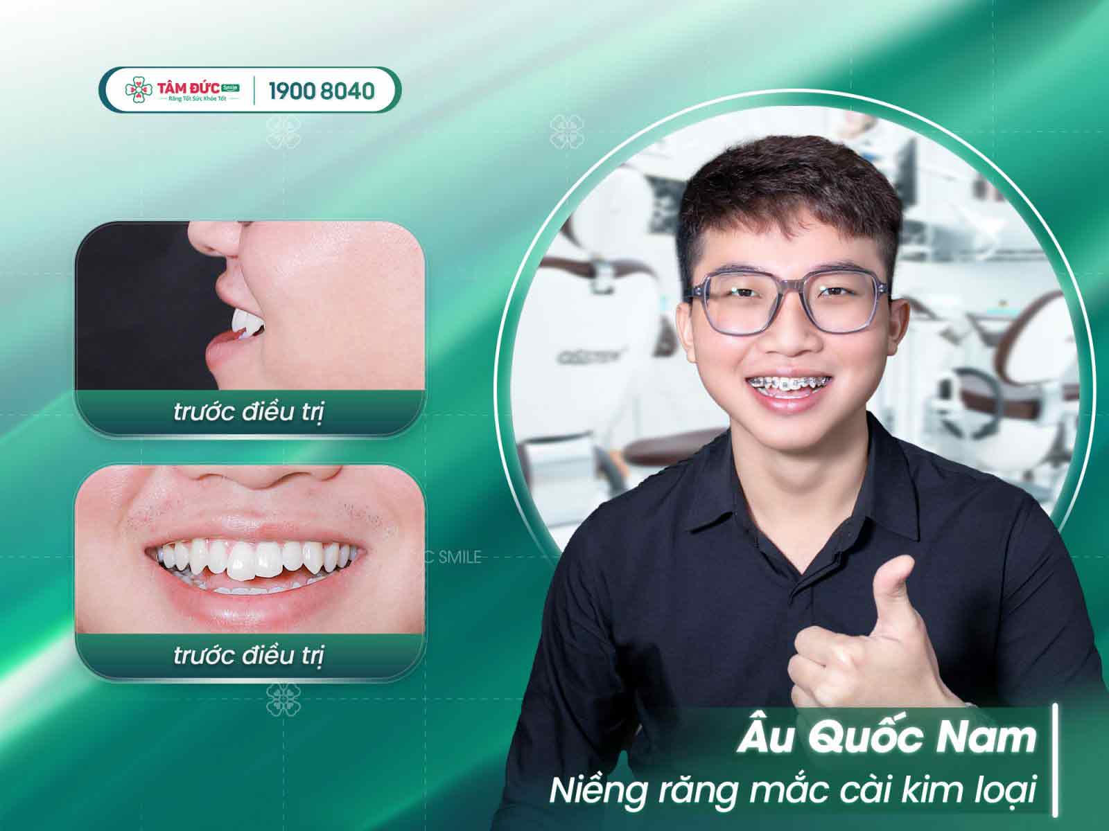 khách hàng niềng răng tại nha khoa Tâm Đức Smile