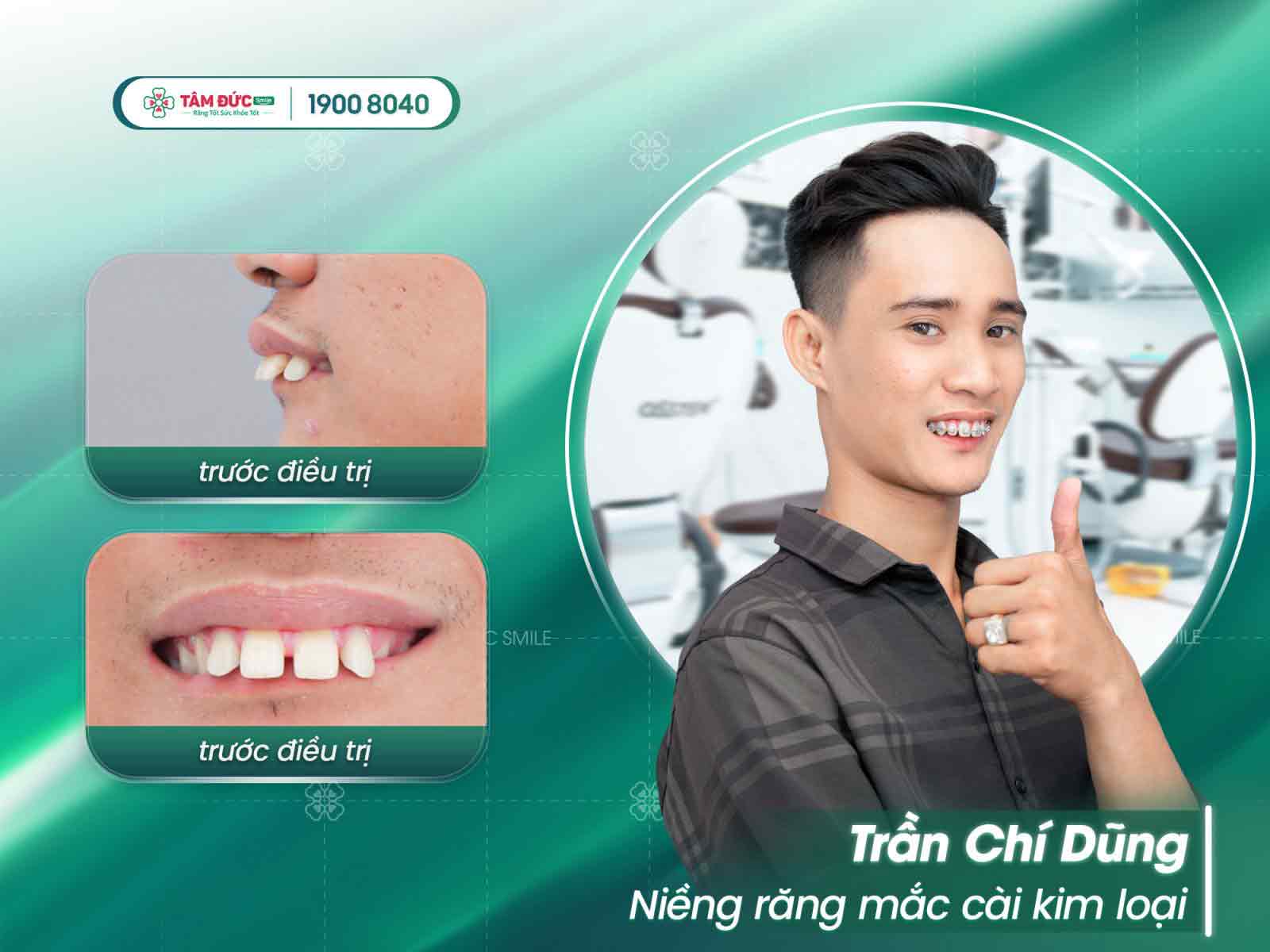 địa chỉ niềng răng uy tín tại thành phố bà rịa vũng tàu