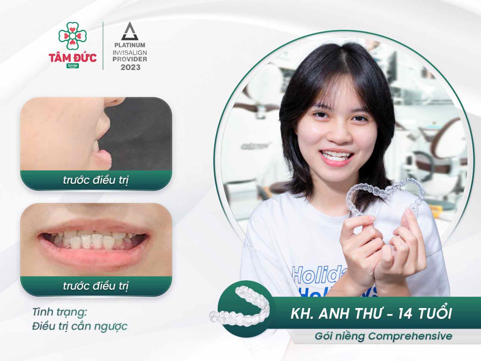 khách hàng niềng răng tại nha khoa Tâm Đức Smile