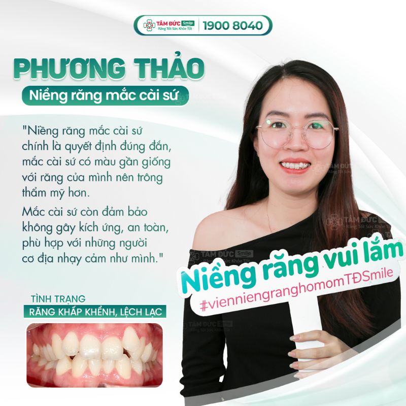 Địa chỉ niềng răng ở Đà Lạt uy tín