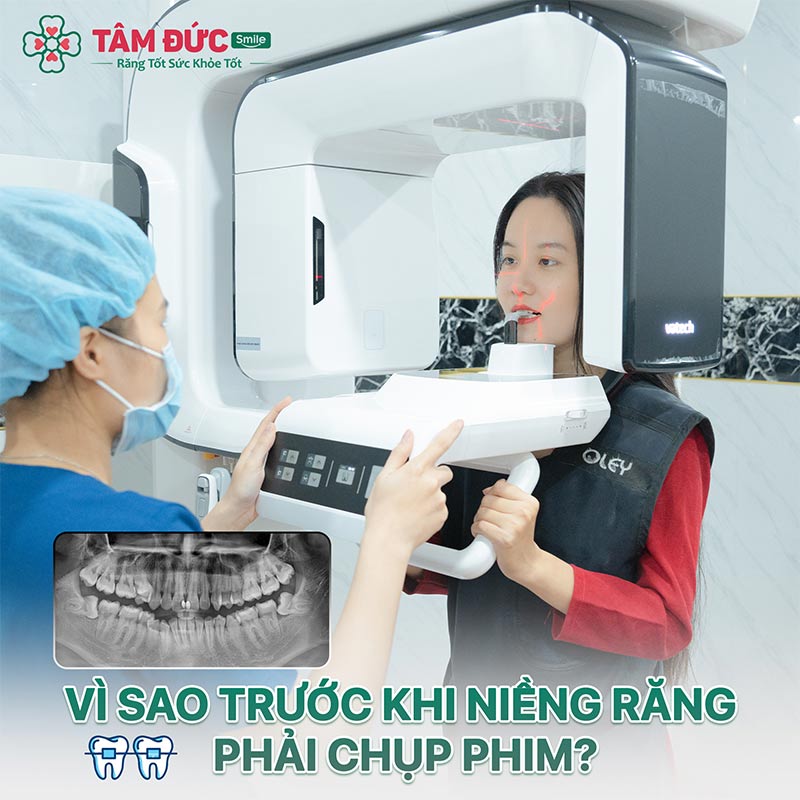 nha khoa Tâm Đức Smile là địa chỉ niềng răng ở tphcm sở hữu công nghệ hiện đại