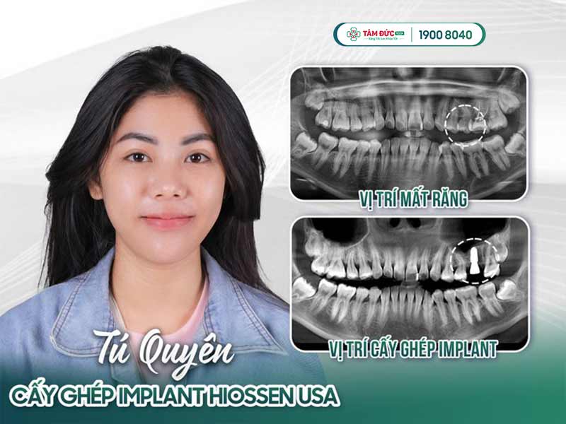 chi nhánh nha khoa Tâm Đức Smile tại Đà Nẵng