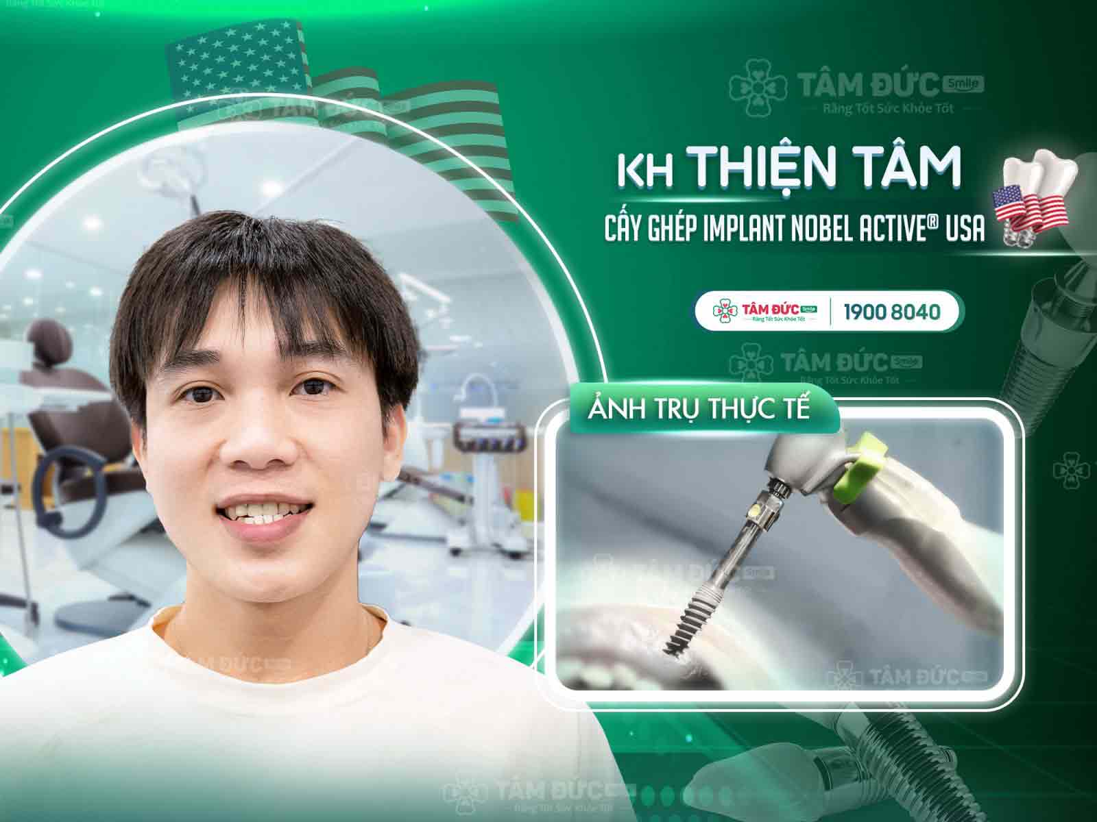 địa chỉ trồng răng implant uy tín tại Tây Ninh