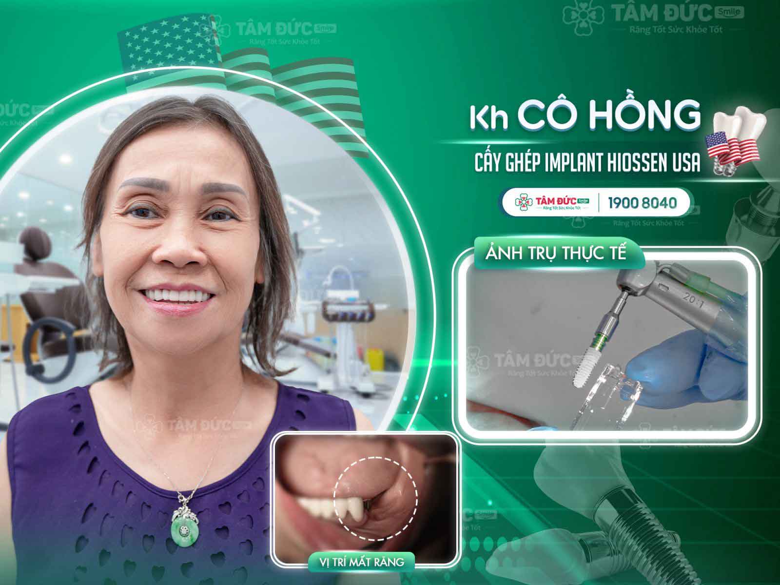 địa chỉ trồng răng implant uy tín tại Tây Ninh