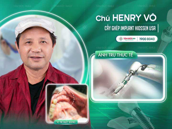 địa chỉ trồng răng tại tây ninh 