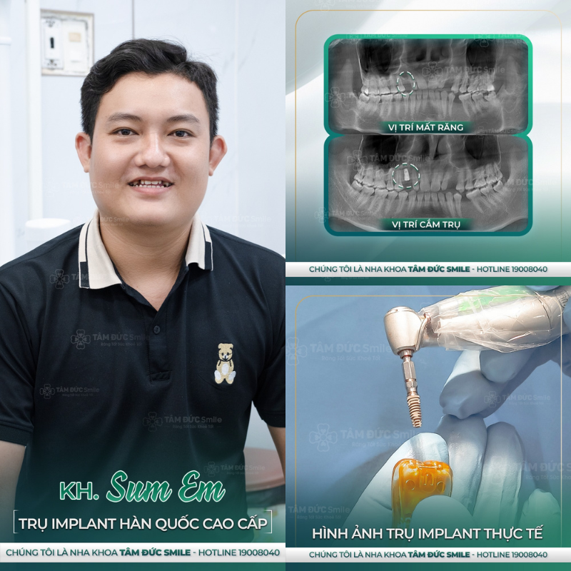 địa chỉ trồng răng implant uy tín tại Tây Ninh