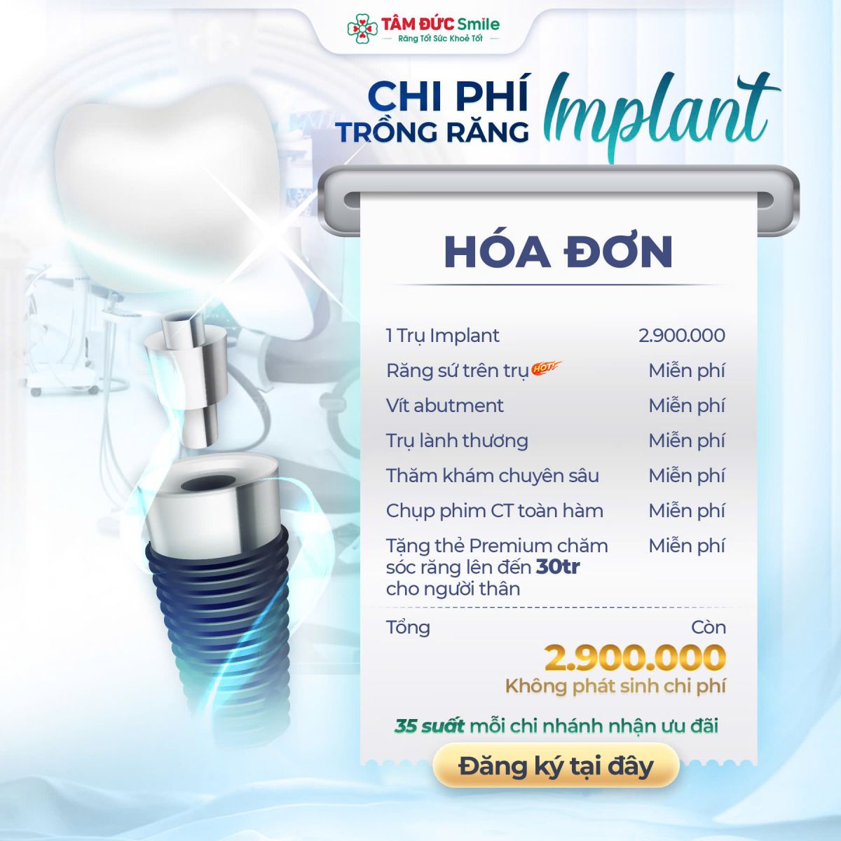 ưu đãi trồng răng implant