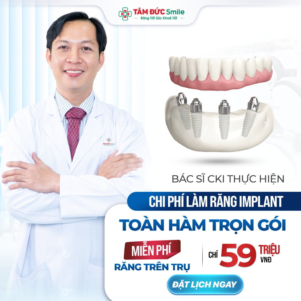 trồng răng implant dịch vụ