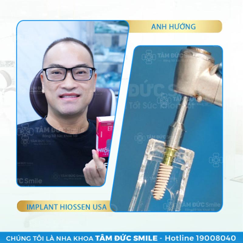 dịch vụ trồng răng implant tâm đức smile