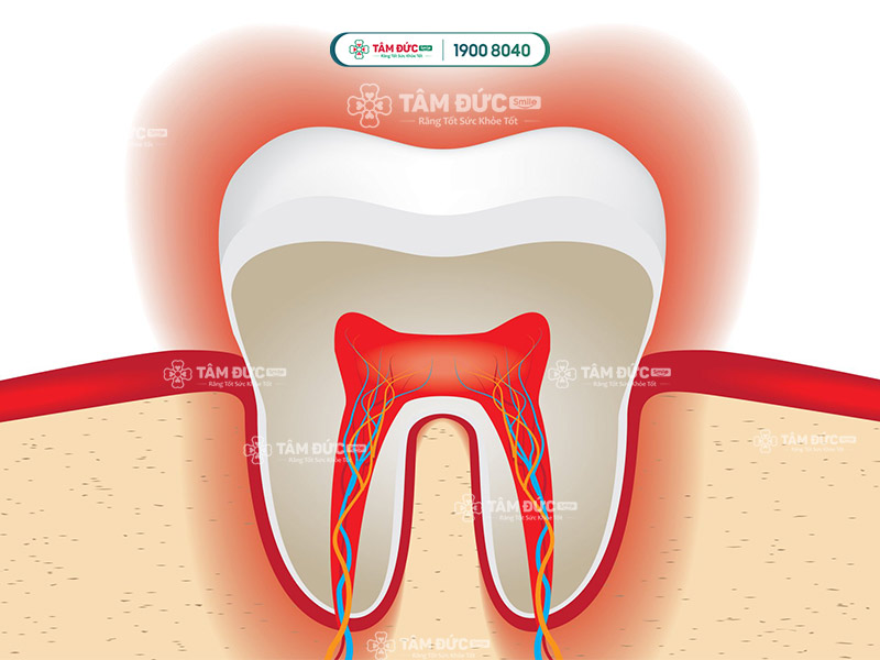 răng nhạy cảm phản ứng với nhiệt độ nóng lạnh