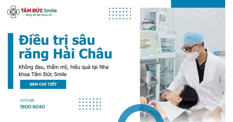 Điều trị sâu răng Hải Châu: Không đau, thẩm mỹ, hiệu quả tại Nha khoa Tâm Đức Smile