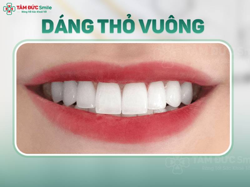 đồng điếu ở rãnh cười tốt hay xấu