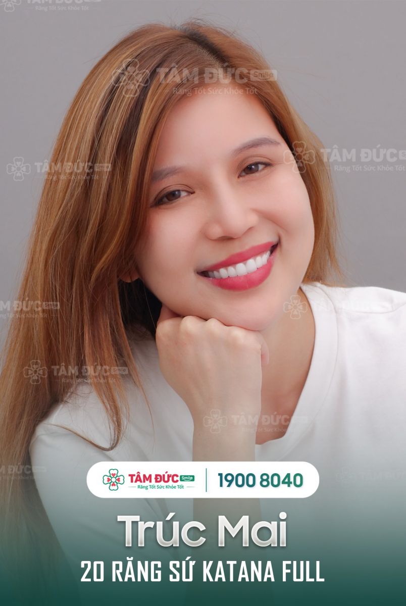 Giá bọc răng sứ cercon tại nha khoa Tâm Đức Smile