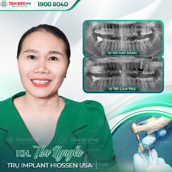 khách hàng trồng răng Implant tại nha khoa tâm đức smile