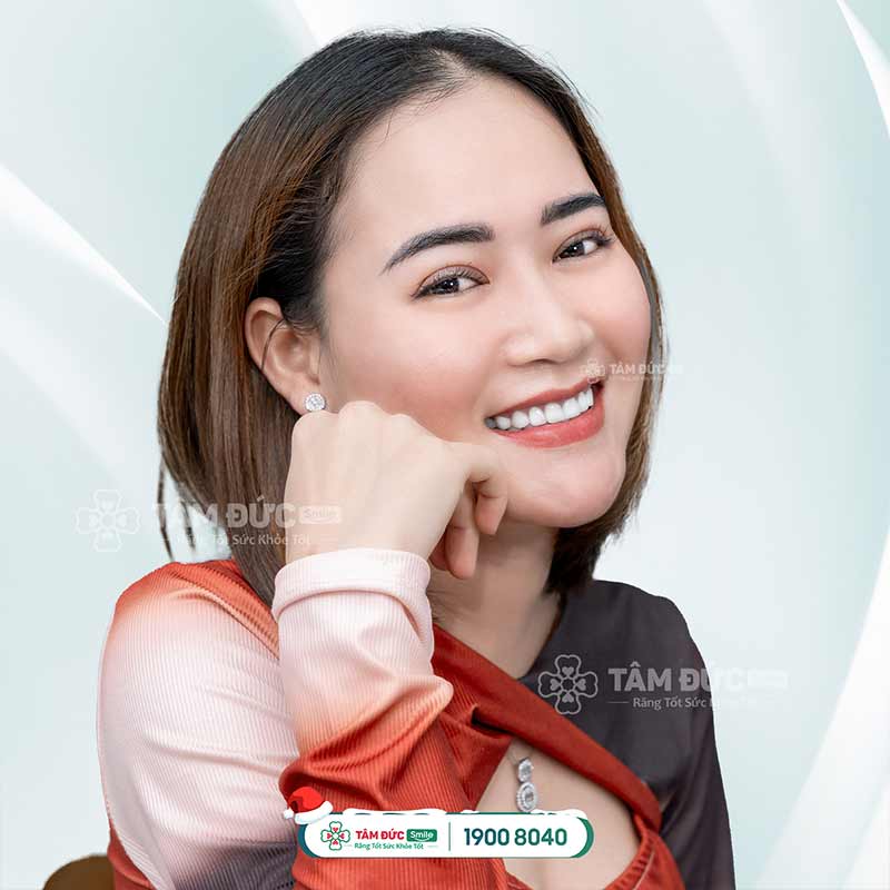 khách hàng bọc răng sứ khắc phục răng nhạy cảm tại nha khoa Tâm Đức Smile