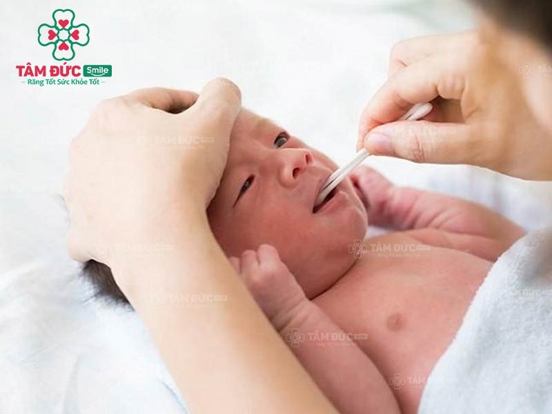 nên rơ lưỡi cho trẻ sơ sinh bao nhiêu lần một tuần