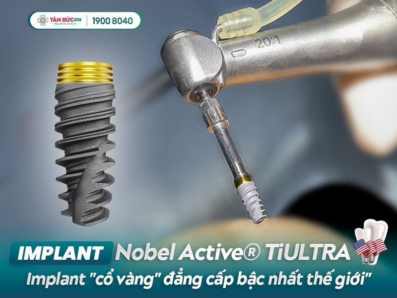 trụ implant nobel active tiultra