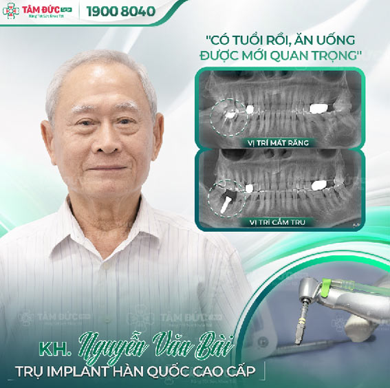 chú Khánh trồng răng Implant tại nha khoa Tâm Đức Smile