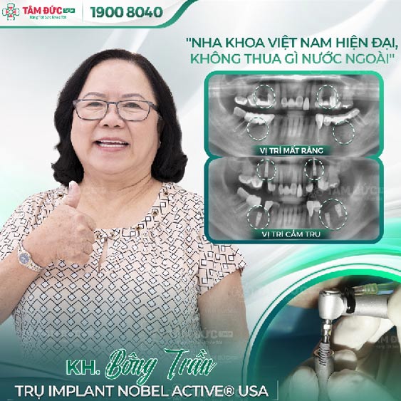 cô Bông trồng răng Implant tại nha khoa Tâm Đức Smile