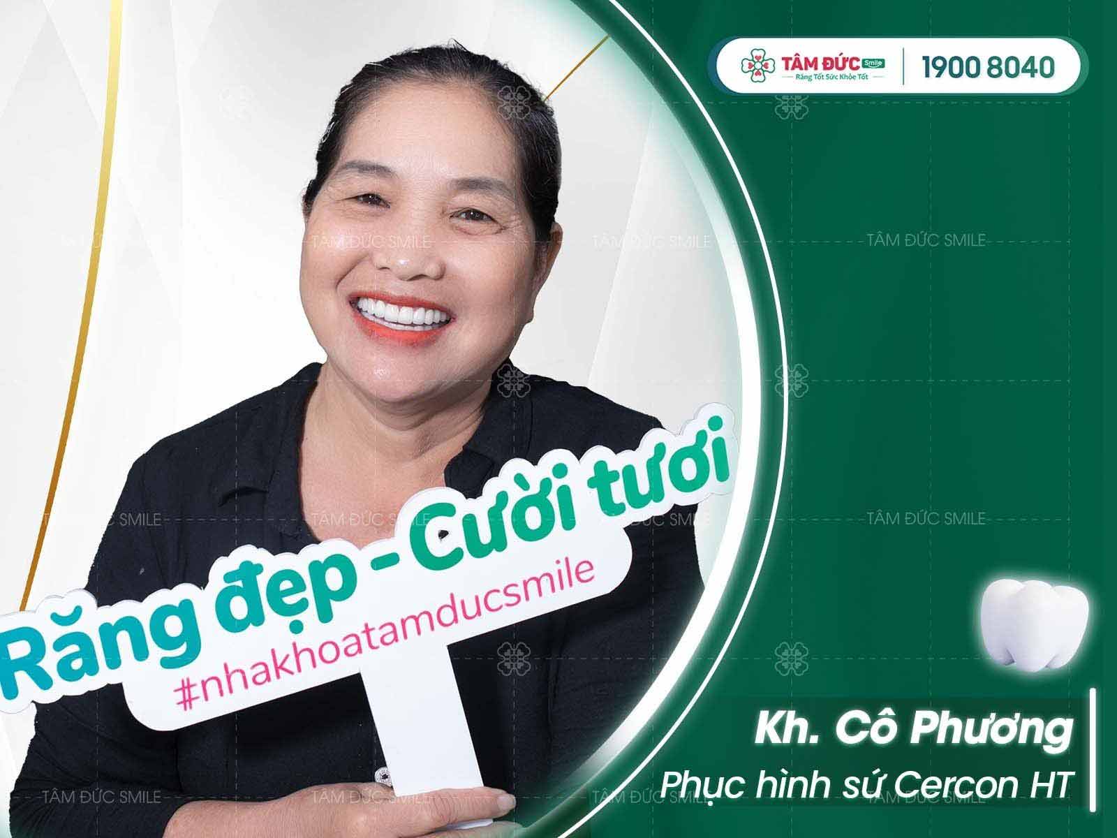 làm 4 răng cửa bọc sứ bao nhiêu tiền