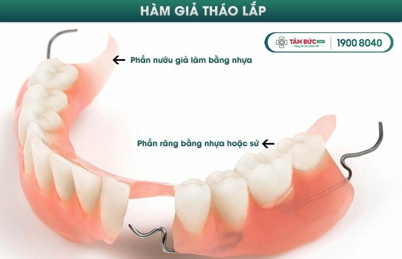 trồng răng giả ở đâu tốt nhất