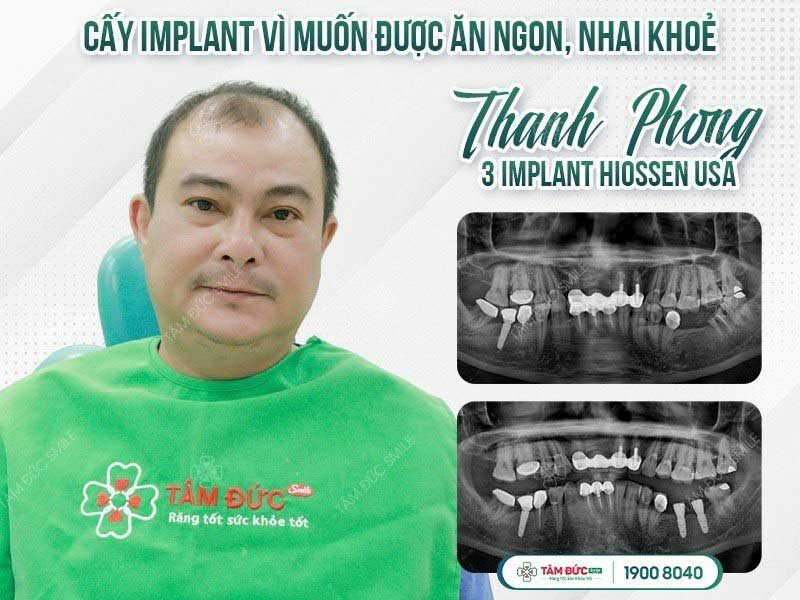 Anh Phong làm răng giả tại nha khoa Tâm Đức Smile