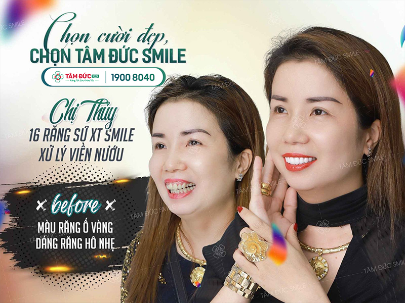 địa chỉ làm răng sứ ở tphcm