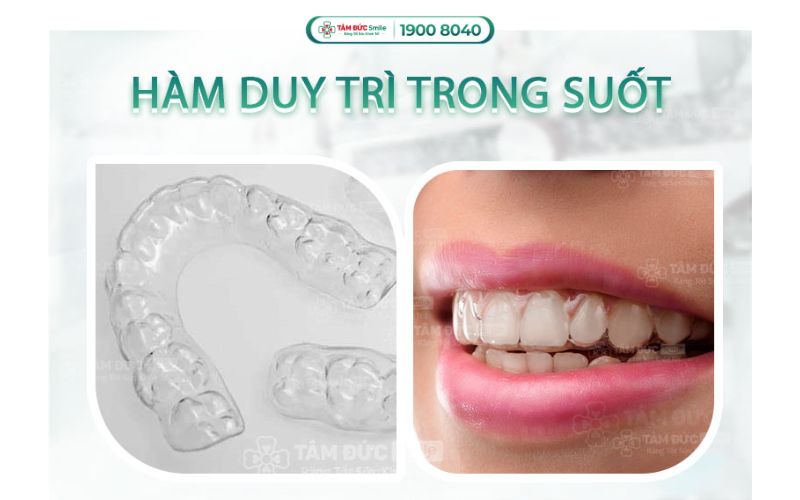 loi-ich-nieng-rang-10