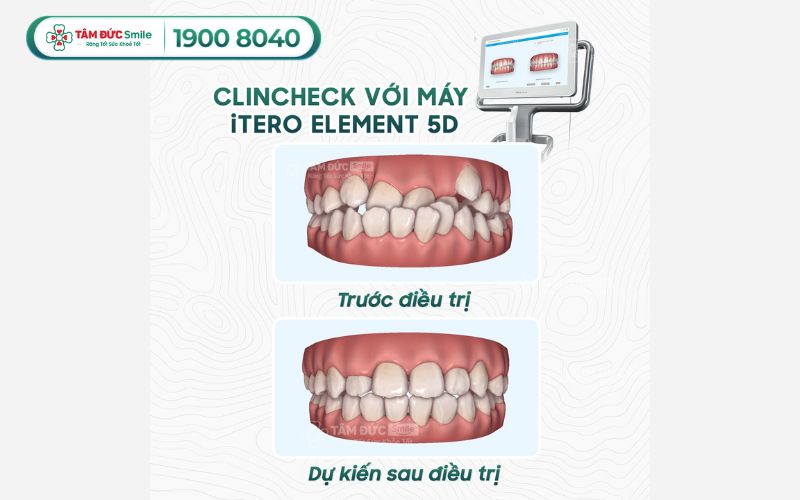 loi-ich-nieng-rang-4
