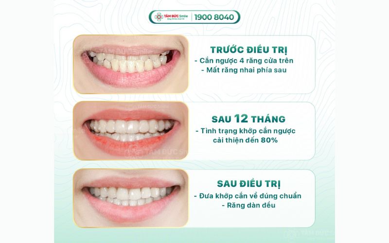 loi-ich-nieng-rang-9
