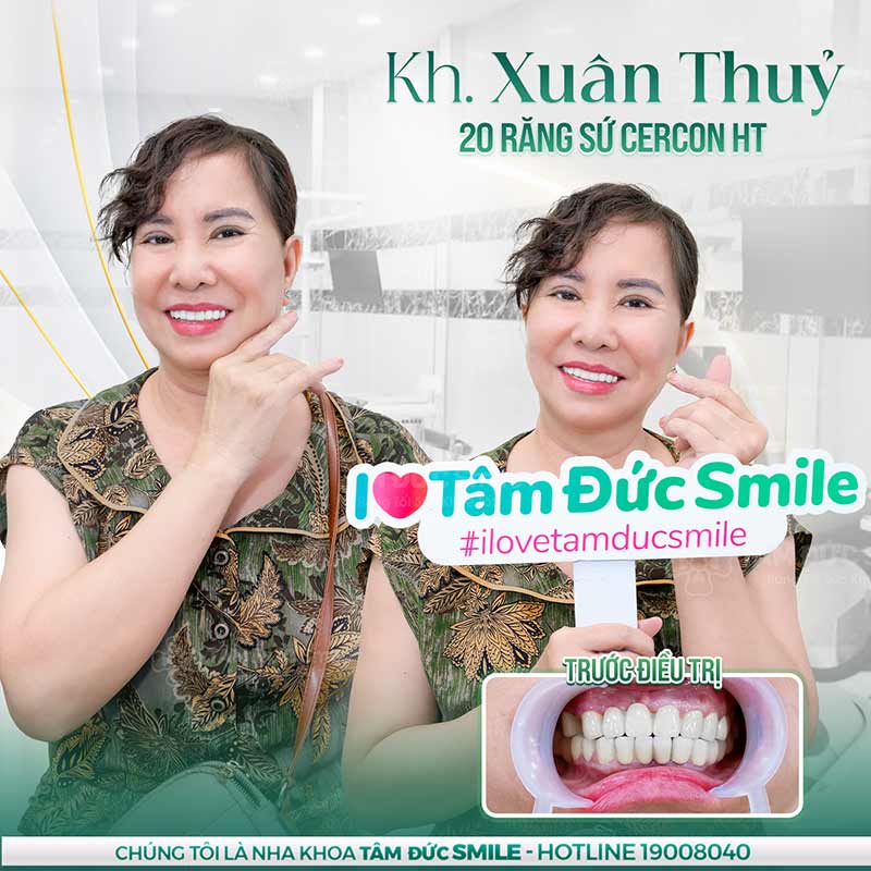 khách hàng làm răng tại nha khoa tâm đức smile