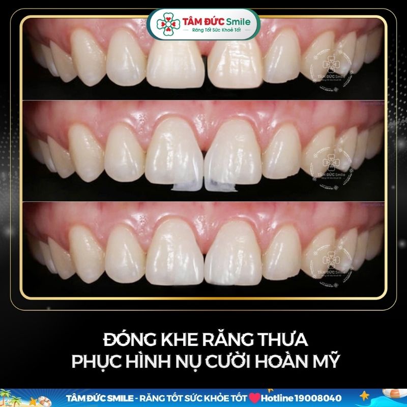 mai-rang-3