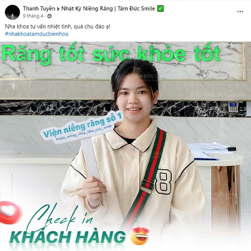 mặt lệch là gì