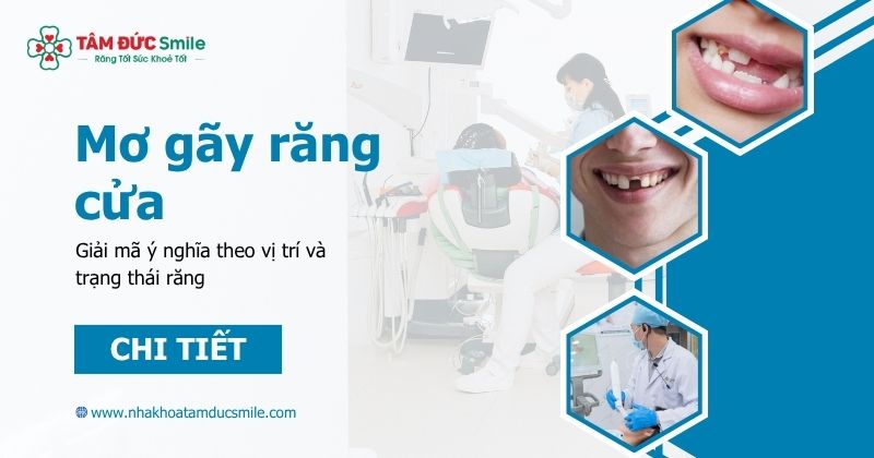 Mơ gãy răng cửa là điềm gì? Giải mã ý nghĩa theo vị trí và trạng thái răng