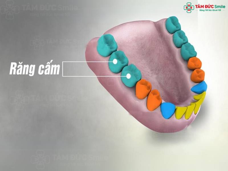 mọc răng cấm bị đau phải làm sao