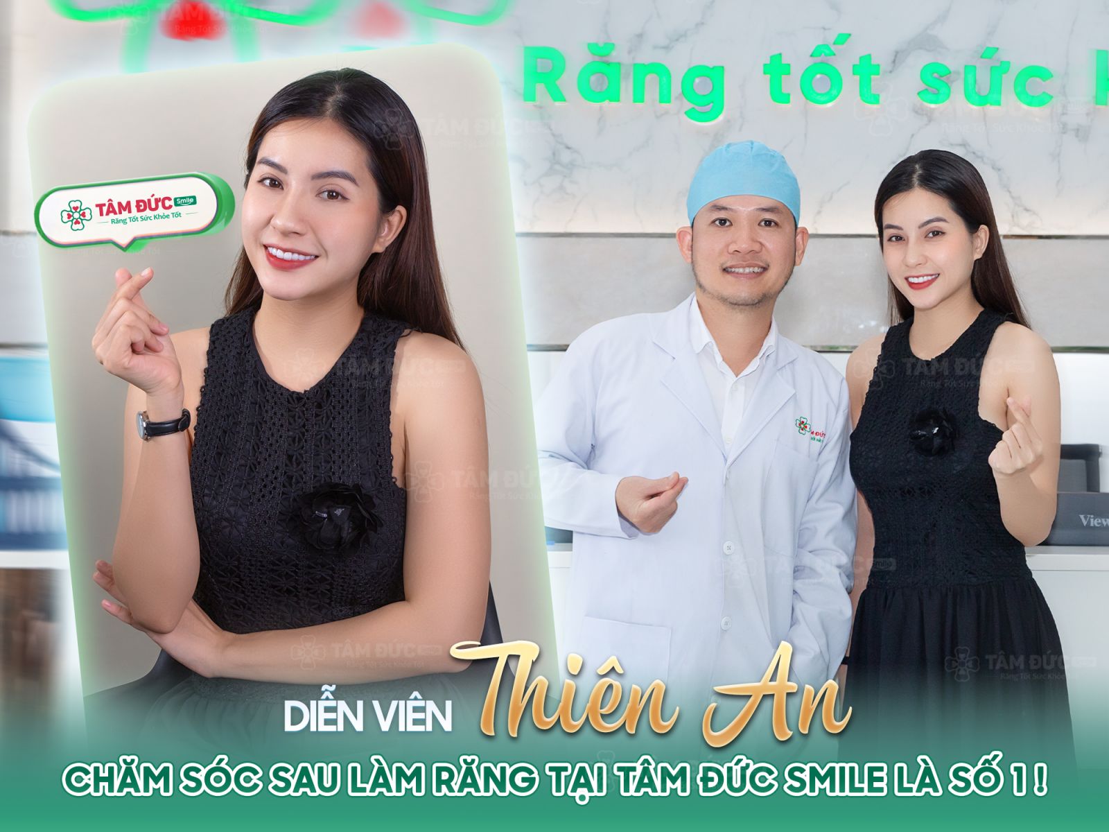 diễn viên Thiên An dán sứ veneer tại nha khoa Tâm Đức Smile