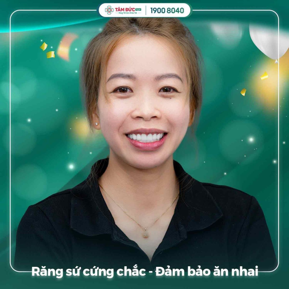 khách hàng sau khi khắc phục răng sứ bị rơi ra tại nha khoa Tâm Đức Smile