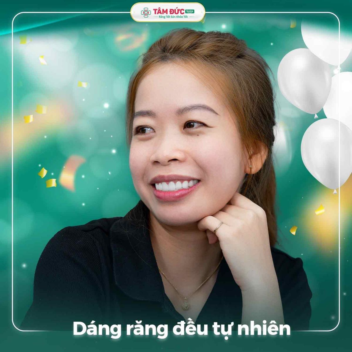 khách hàng sau khi khắc phục răng sứ bị rơi ra tại nha khoa Tâm Đức Smile