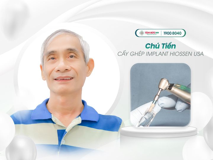 các nguyên nhân gây sưng lợi răng cửa