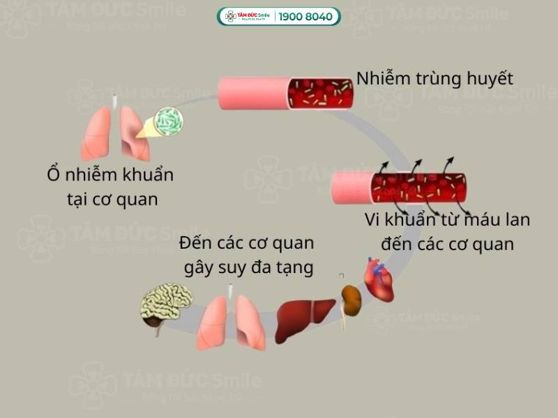 nhiễm khuẩn máu là gì