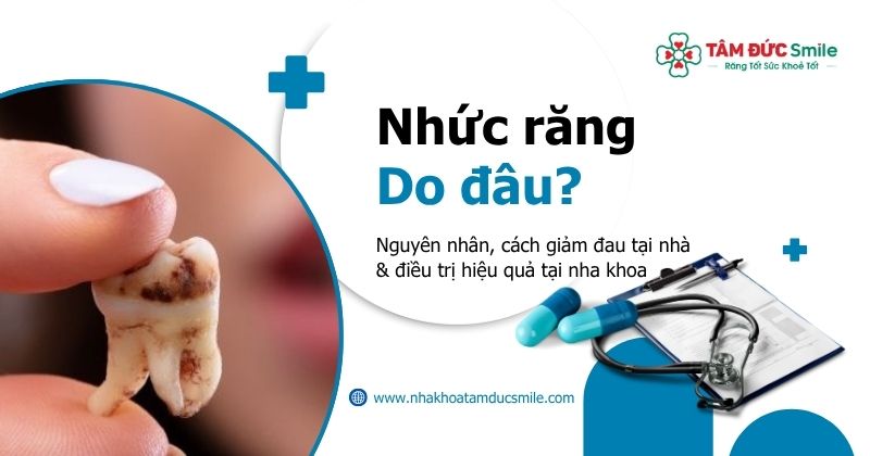 Nhức răng: Nguyên nhân, cách giảm đau tại nhà & điều trị hiệu quả tại nha khoa