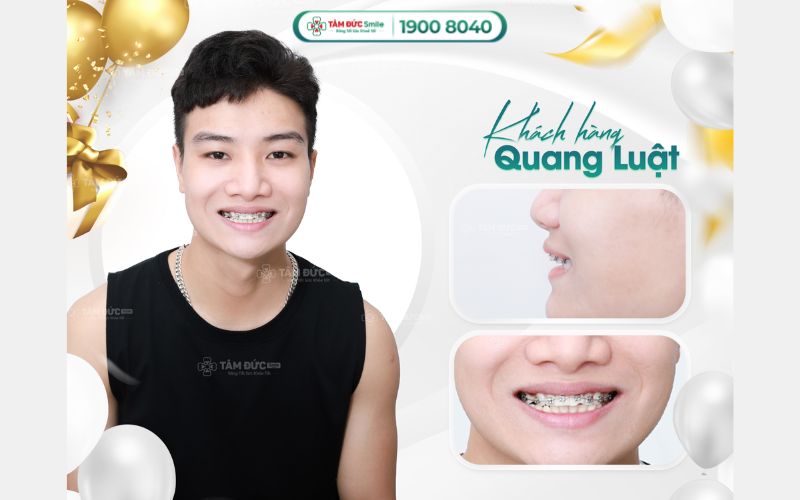 nieng-rang-1-ham-tren-gia-bao-nhieu-1