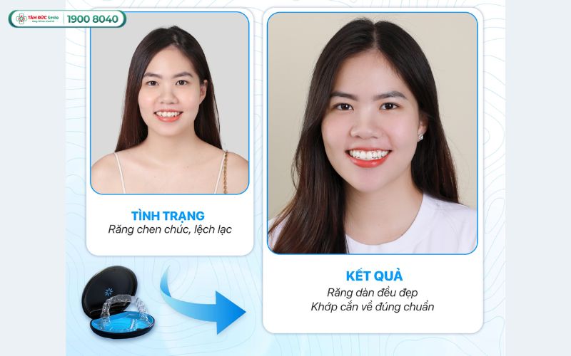 nieng-rang-1-ham-tren-gia-bao-nhieu-3