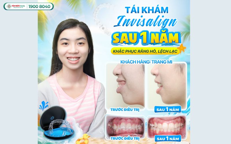 nieng-rang-1-ham-tren-gia-bao-nhieu-6