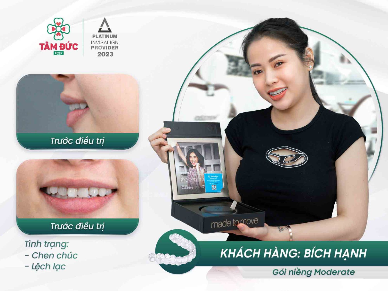 khách hàng niềng răng trong suốt tại nha khoa Tâm Đức Smile