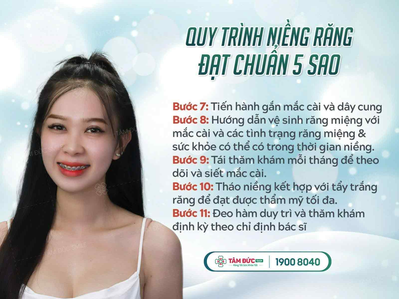 quy trình niềng răng cần lưu ý gì